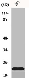 SCN2B antibody