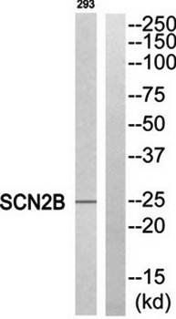 SCN2B antibody