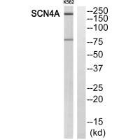 SCN4A antibody