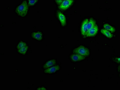 SCN4B antibody