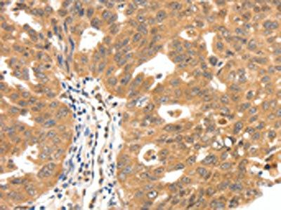SCN5A Antibody