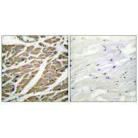 SCN5A Antibody