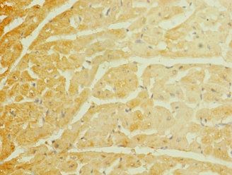 SCN7A Antibody