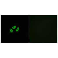 SCN7A Antibody