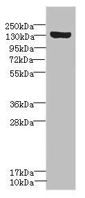 SCN8A antibody