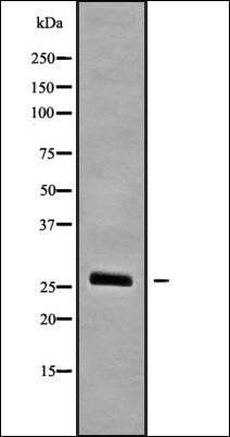 SCNM1 antibody