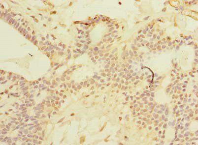 SCNM1 Antibody