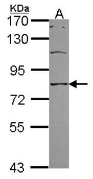 SCNN1A antibody
