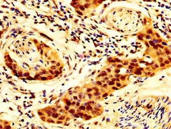 SCNN1B Antibody