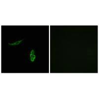 SCNN1D Antibody