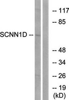 SCNN1D Antibody