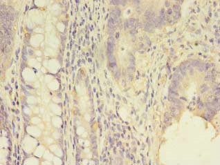 SCNN1G Antibody
