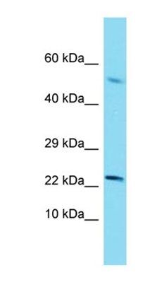 SCP2 antibody