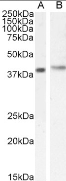 Goat anti-CYBR / PSCDBP Antibody