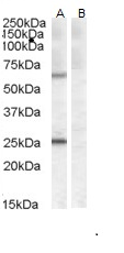Goat anti-COL4A3BP (aa662-672) Antibody