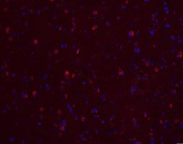 AD7c-NTP Mouse Monoclonal Antibody