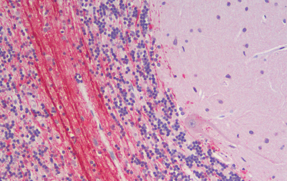 Goat anti-Robo3.2 (mouse aa1303-1316) Antibody