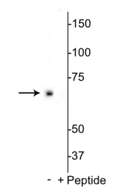 p70 S6 Kinase (Ser398) Antibody