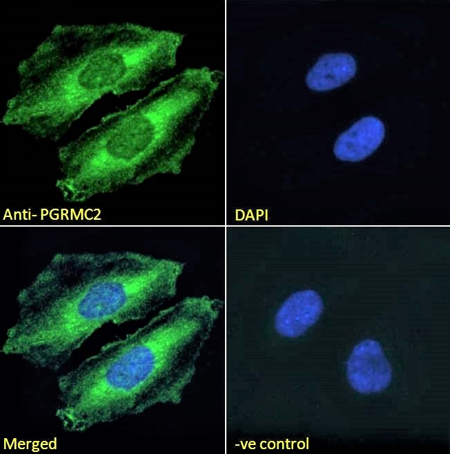Goat anti-PGRMC2 Antibody