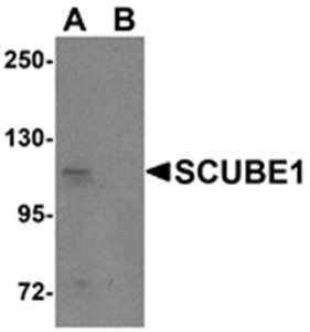 SCUBE1 Antibody