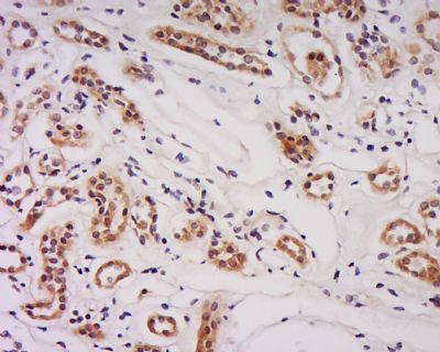 SCUBE2 Rabbit Polyclonal Antibody