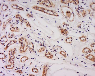 SCUBE2 antibody