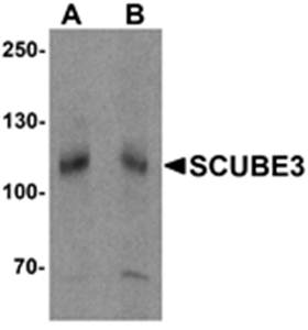 SCUBE3 Antibody