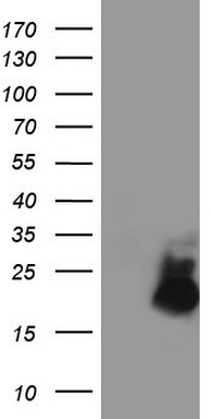 SCYL1BP1 (GORAB) antibody