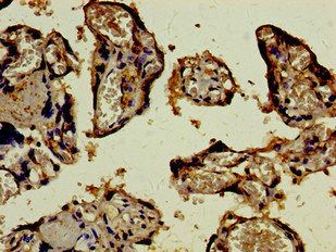 SCYL3 Antibody