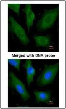 SCYL3 antibody