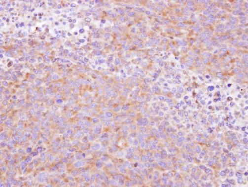 SCYL3 Rabbit Polyclonal Antibody