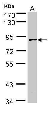 SCYL3 Rabbit Polyclonal Antibody