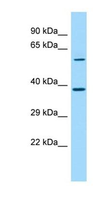 SDAD1 antibody