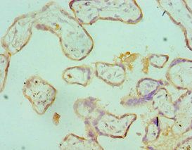 SDC1 antibody