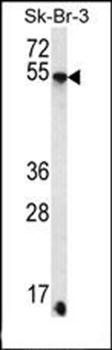 SDC3 antibody