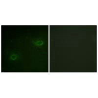 SDC4 (Ab-179) Antibody