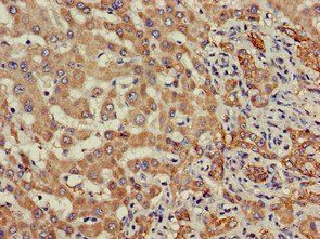 SDC4 antibody