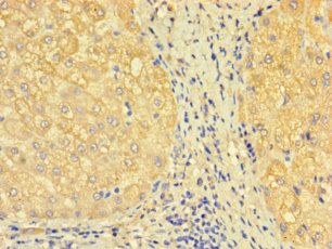 SDCBP2 Antibody