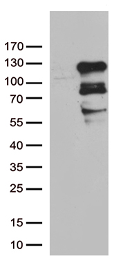 SDCCAG10 (CWC27) antibody