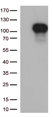 SDCCAG10 (CWC27) antibody