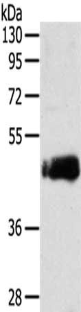 SDCCAG3 antibody