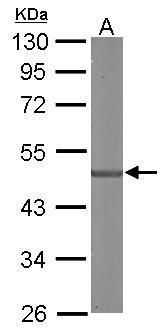 SDCCAG3 Rabbit Polyclonal Antibody