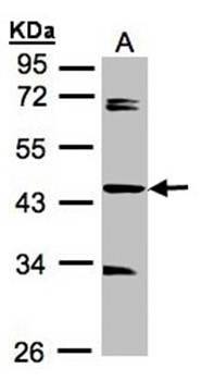 serologically defined colon cancer antigen 3 isoform 1 antibody