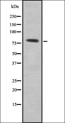 SDCCAG8 antibody