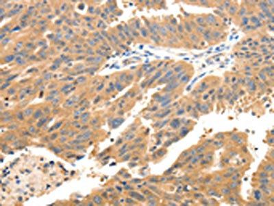 CXCL12 Antibody