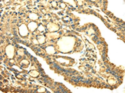 SDHA Antibody