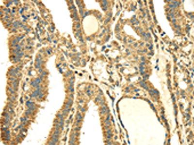 SDHA Antibody