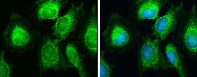 SDHB antibody