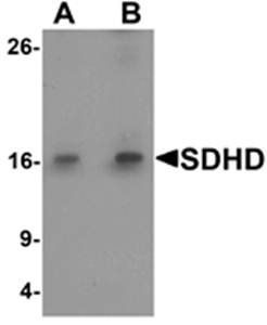 SDHD Antibody