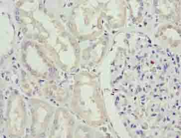 SDSL antibody